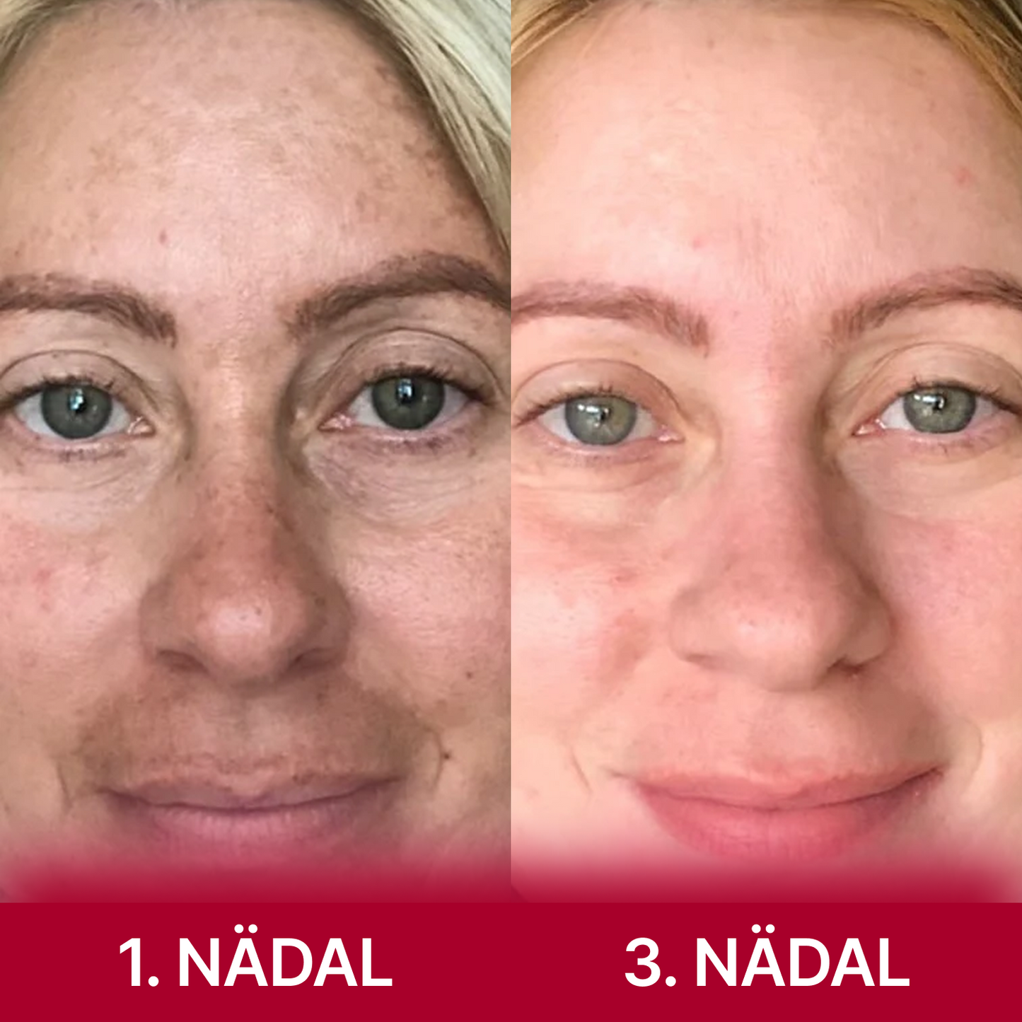 kojikhappe ja kurkumi näopadjad