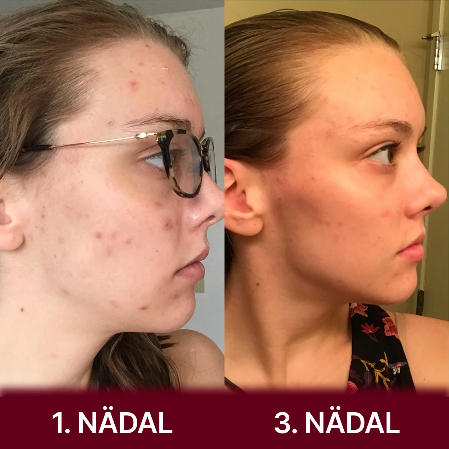 Kojikhappe ja kurkumi näopadjad