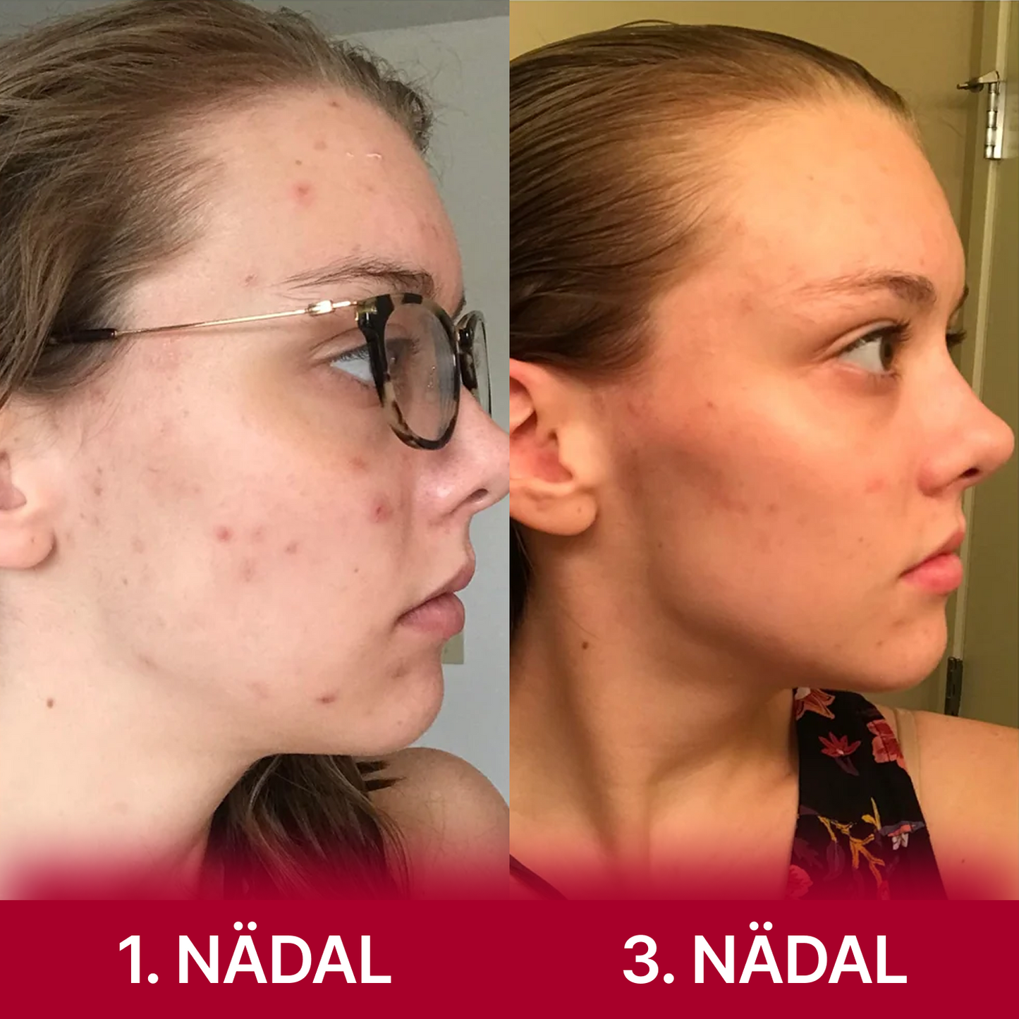 kojikhappe ja kurkumi näopadjad