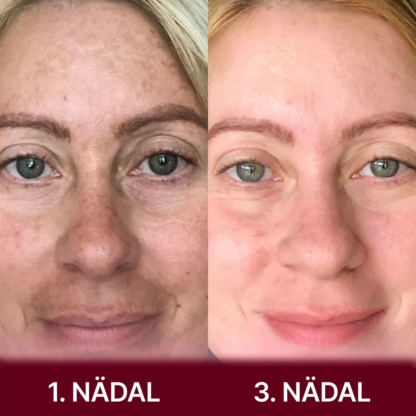 Kojikhappe ja kurkumi näopadjad